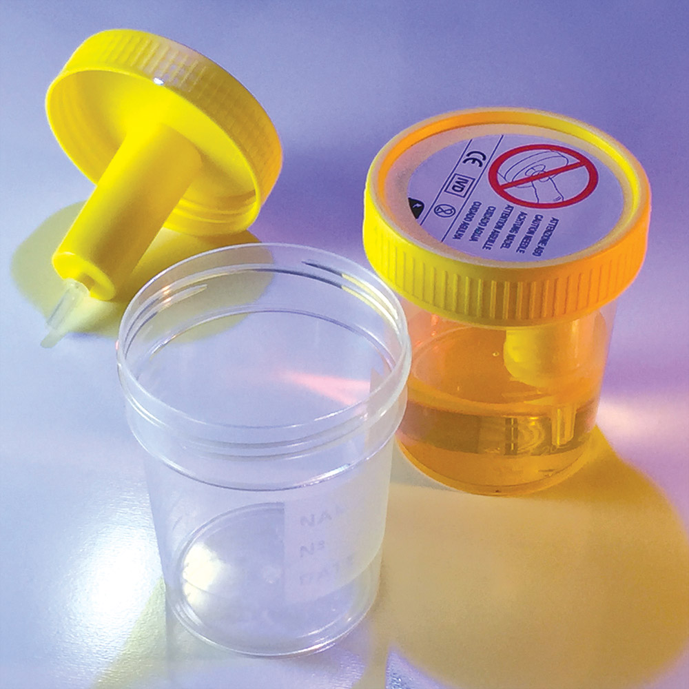 Globe Scientific TransferTop Urine Collection Cup with Integrated Transfer Device, 4oz (120mL), Graduated to 100mL, STERILE, Bulk Image