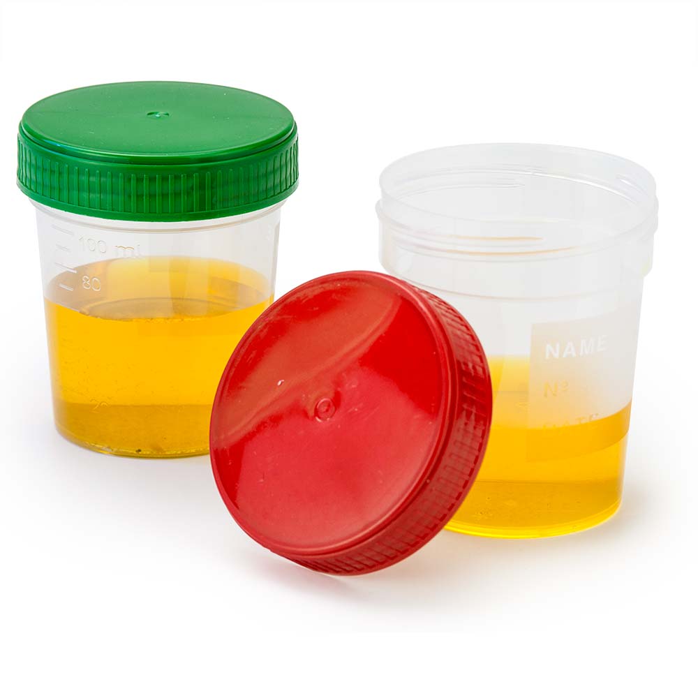 Globe Scientific Specimen Container, 4oz, with Full Turn Red Separate Screwcap, Frosted Writing Area, Non-Sterile, PP, Graduated Image